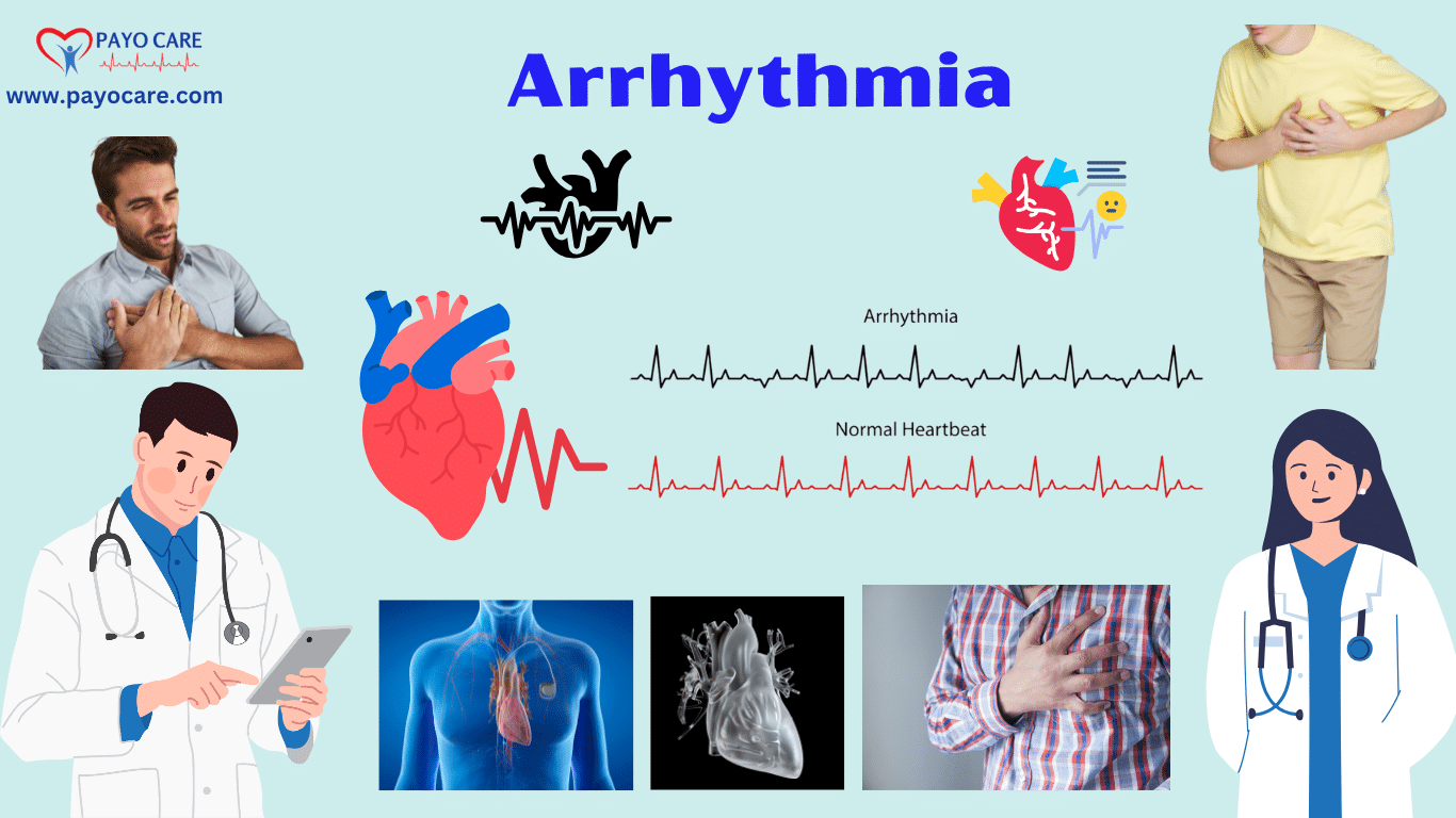 Arrhythmia: Causes, Symptoms, Prevention & Treatment