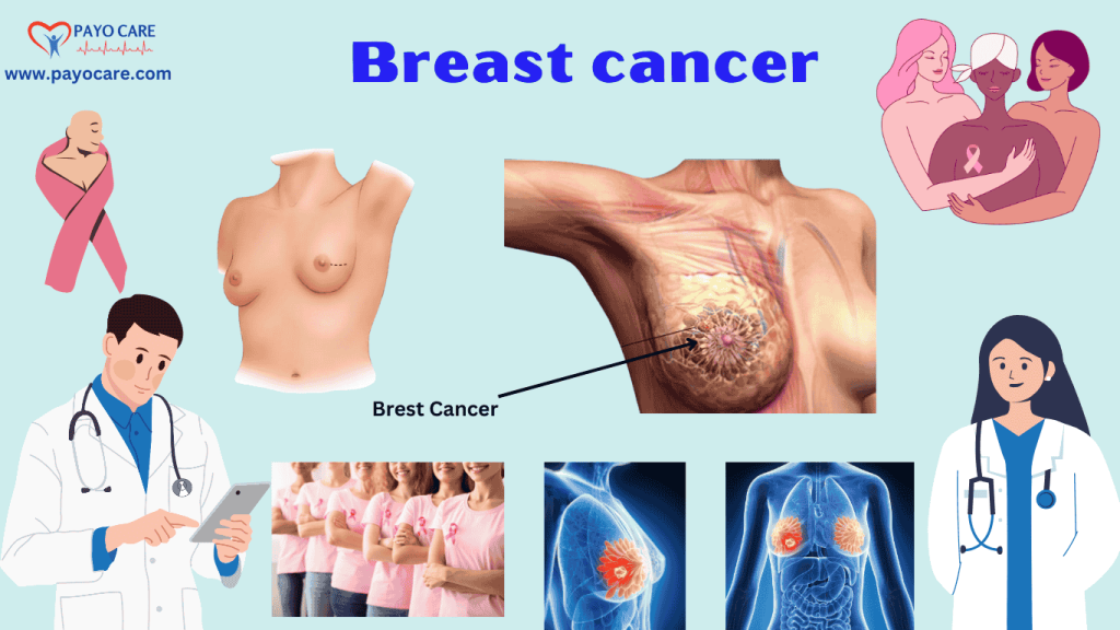 Breast Cancer: Types, Causes, Symptoms, Prevention & Treatment Breast Cancer: Types, Causes, Symptoms, Prevention & Treatment