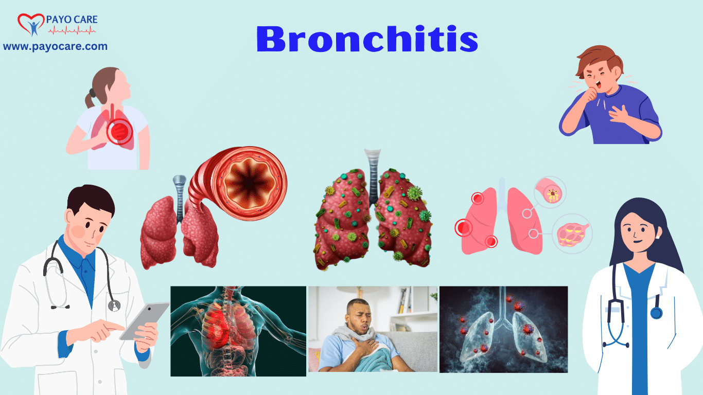 Bronchitis: Causes, Symptoms, Treatment & Prevention