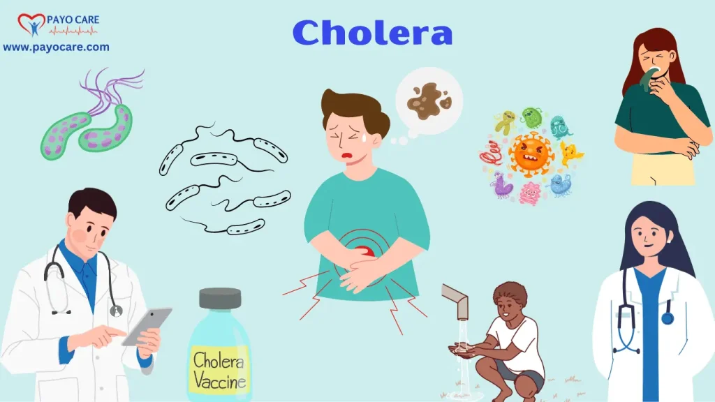 Cholera: Types, Causes, Symptoms, Prevention, Diagnosis, and Treatments Cholera: Types, Causes, Symptoms, Prevention, Diagnosis, and Treatments