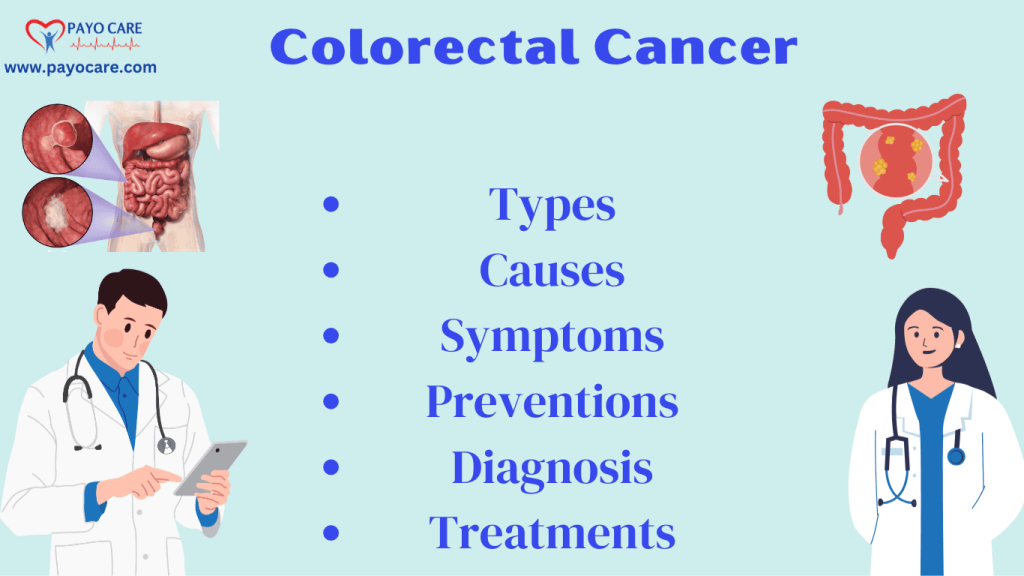 Colorectal Cancer: Types, Causes, Symptoms, Prevention, Diagnosis, and Treatments Colorectal Cancer: Types, Causes, Symptoms, Prevention, Diagnosis, and Treatments
