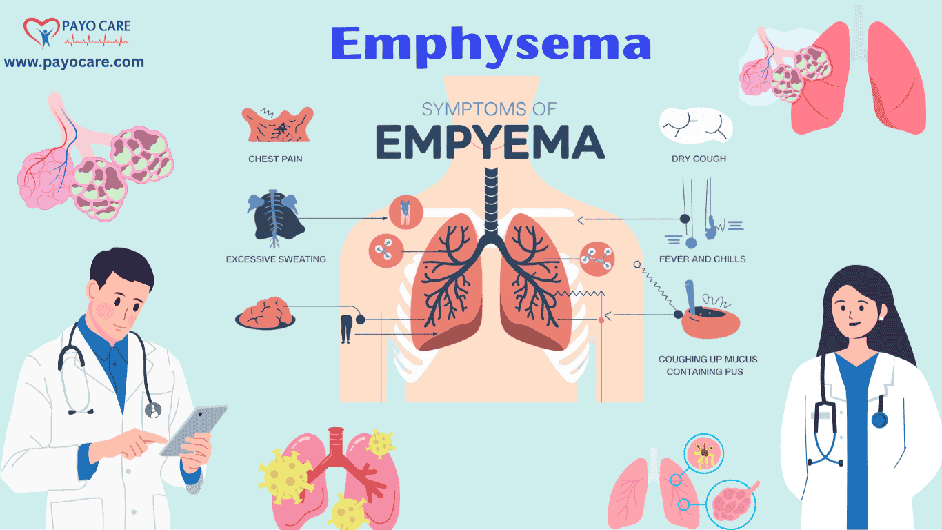 Emphysema: Causes, Symptoms & Treatment