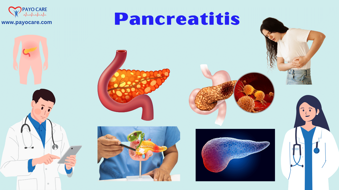 Pancreatitis:Causes, Symptoms, Prevention & Treatment