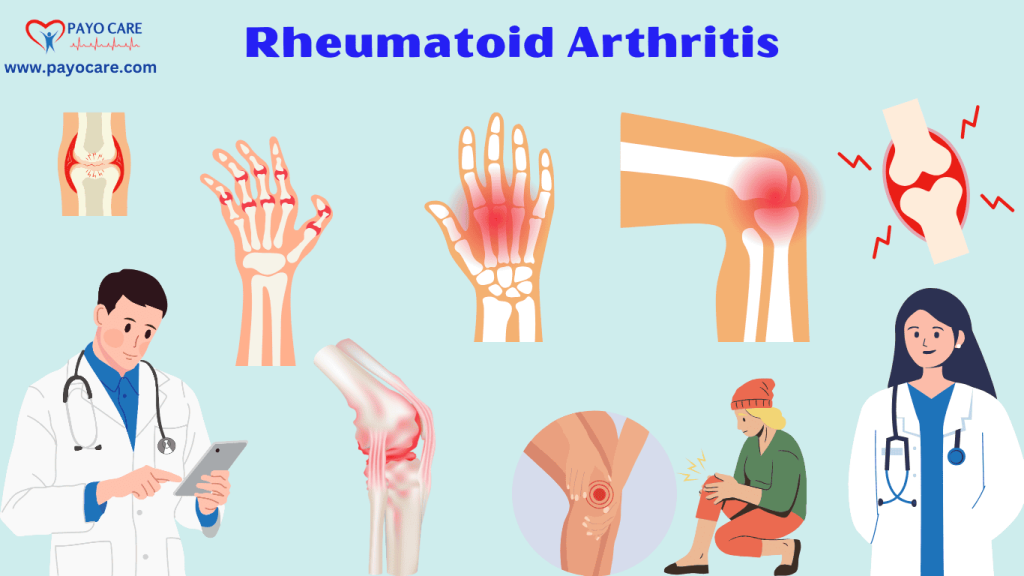 Rheumatoid Arthritis :Types, Causes, Symptoms, Prevention, Diagnosis & Treatment