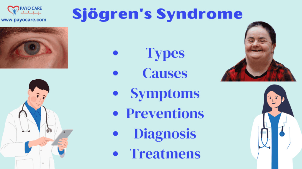 Sjögren's Syndrome: Types, Causes, Symptoms, Prevention, Diagnosis, and Treatments Sjögren's Syndrome: Types, Causes, Symptoms, Prevention, Diagnosis, and Treatments