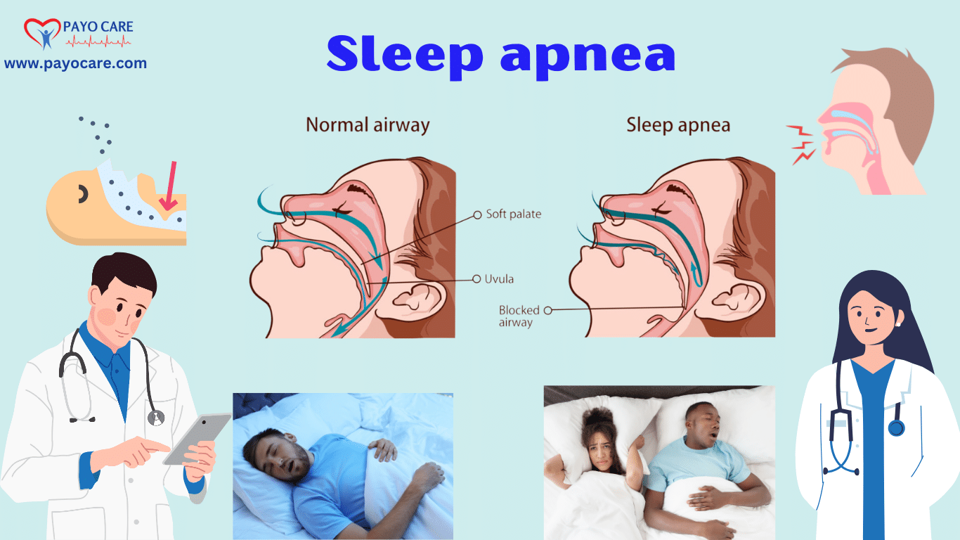 Sleep Apnea: Types, Causes, Symptoms & Treatment
